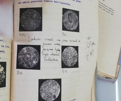 Stampe fotografiche dei vetrini con analisi al microscopio