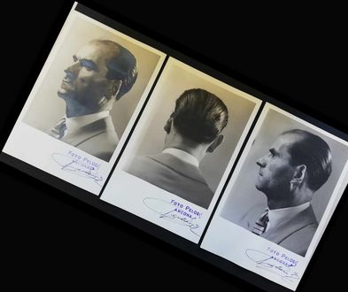 Fotografie di Mario di Maio atte ad accertare l’entità dello sfregio permanente provocato a seguito del morso di un orecchio, conservate nel fascicolo processuale della Corte d'Assise.